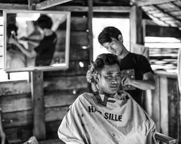 The Future of Hair Loss Treatments Innovations Ahead