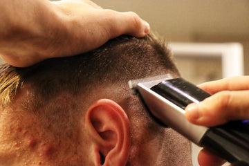 Effective Solutions for Men's Thinning Hair with Trioxidil