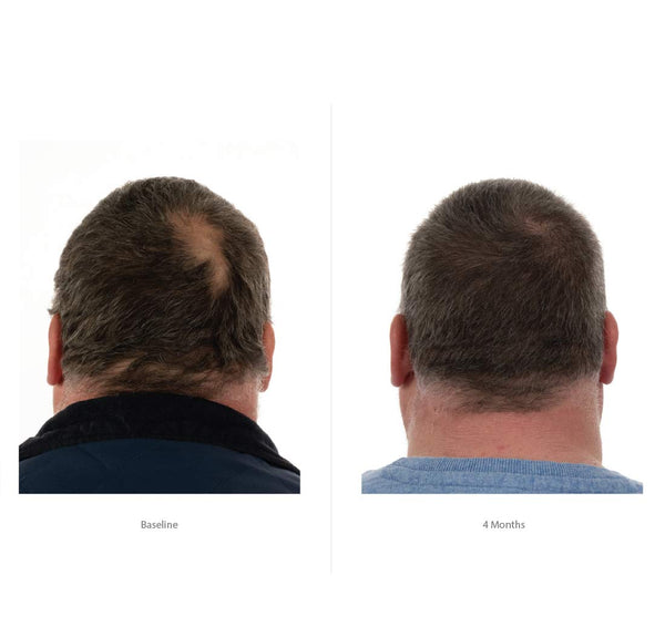 FOLIGAIN Hair Growth Shampoo + Conditioner Kit For Men - FOLIGAIN EUROPE