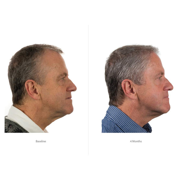 FOLIGAIN Advanced Hair Regrowth Hair Shampoo Minoxidil 2% - FOLIGAIN EUROPE