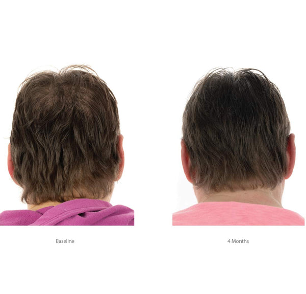 FOLIGAIN Hair Growth Shampoo + Conditioner Kit For Women - FOLIGAIN EUROPE